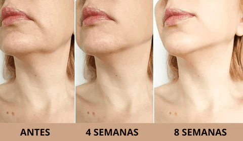 Resultados antes y después 4 y 8 semanas